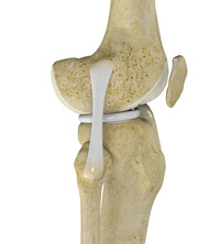 Lateral Collateral Ligament (LCL) Reconstruction