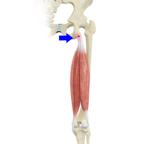 Proximal Hamstring Tears